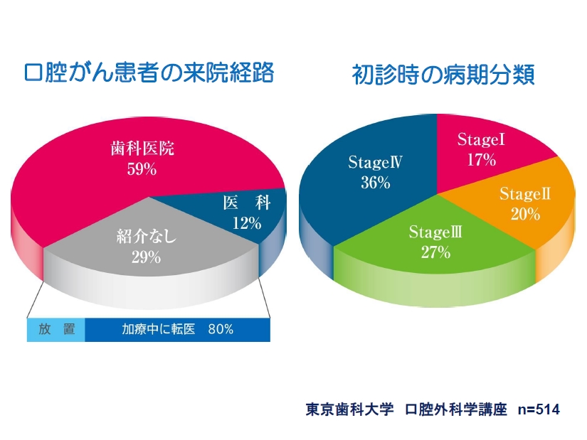 http://www.oralcancer.jp/%E3%81%8C%E3%82%93%E6%82%A3%E8%80%85%E3%81%AE%E6%9D%A5%E9%99%A2%E7%B5%8C%E8%B7%AF.jpg