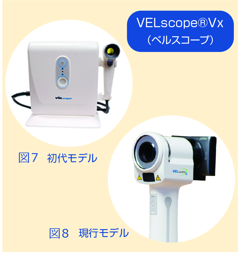 図7 VELscope®Vx(ベルスコープ)初代モデル 図8 VELscope®Vx(ベルスコープ)現行モデル