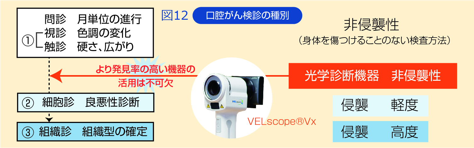 口腔がん検診の種別