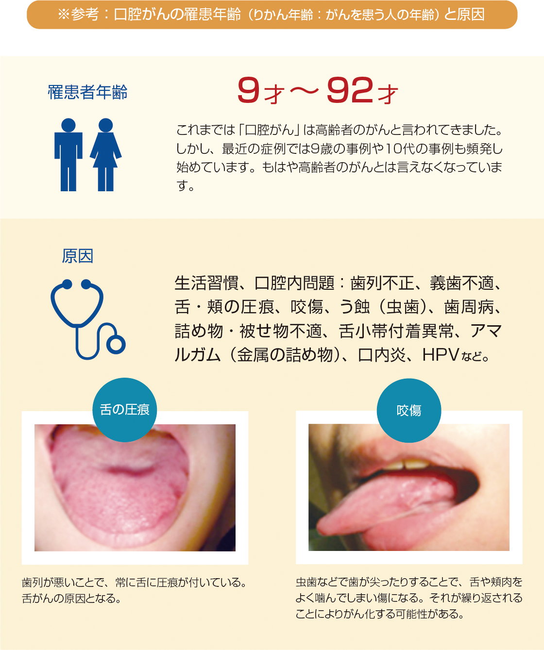 ※参考:口腔がんの罹患年齢(りかん年齢:がんを患う人の年齢)と原因