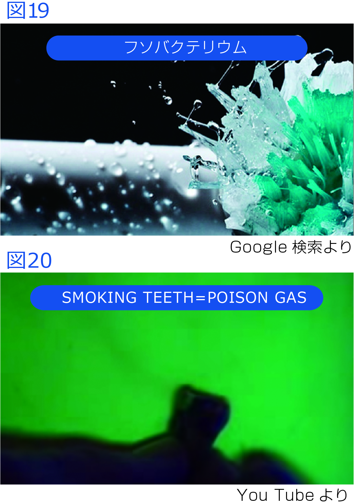図19 フンバクテリウム 図20 SMOKING TEETH=POISON GAS