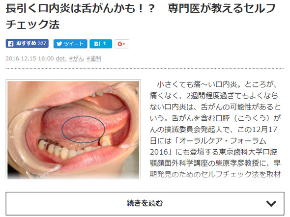 毎日新聞（デジタル版）